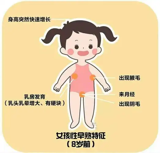 是指女童在8岁前,男童在9岁前呈现第二性征发育的异常性疾病