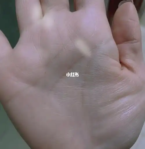 手心不知不觉长了一颗朱砂痣,不过还是蛮小一颗.