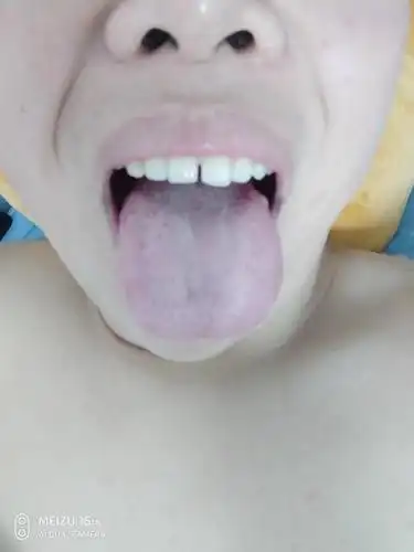 这舌头是肾阳虚吗?