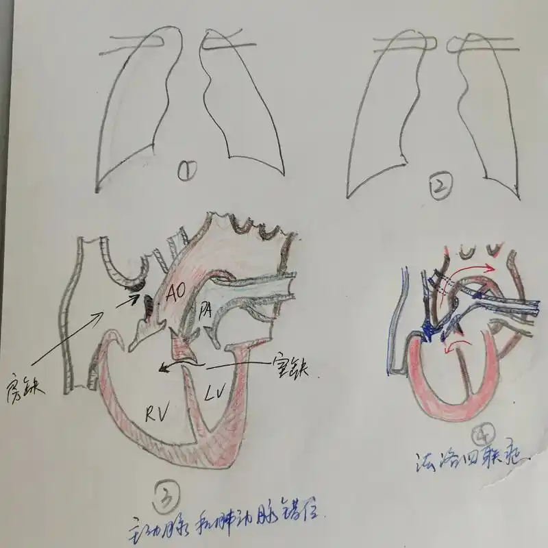 手绘心脏结构图