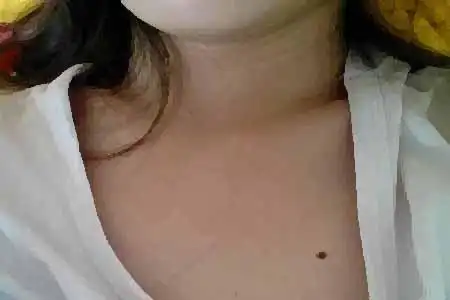 胸口有痣的女人好不好