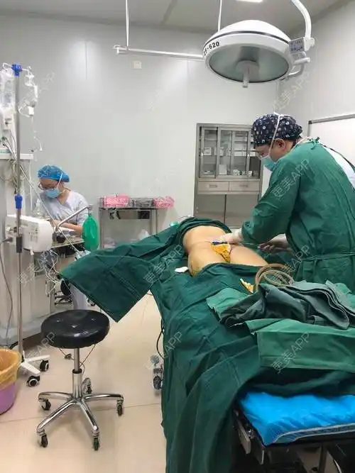 热泪都为你操的腰腹吸脂日记