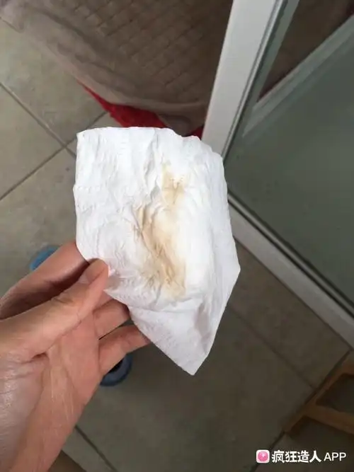 有图!这种褐色分泌物正常吗