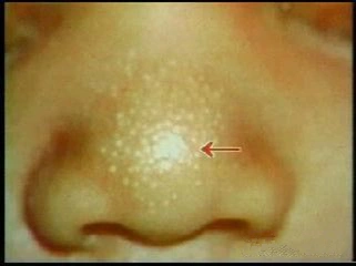 新生儿的一些特殊生理现象_婴儿期_百度经验