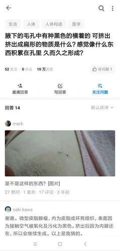 有无jm腋下毛孔里长了类似黑头的东西