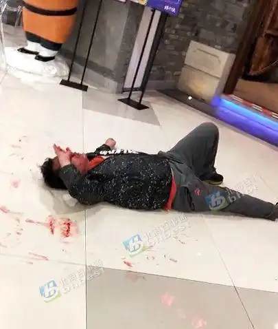 可怕!北海某商场有人打架,一男子满脸是血!