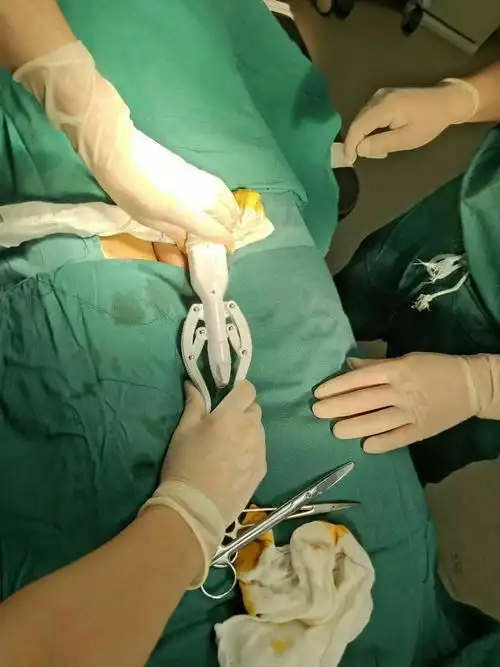 定南中医院为男性朋友解除烦恼,包皮手术只要5分钟,无出血无副作用