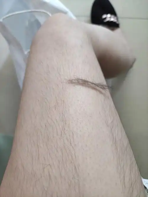 女生腿毛旺盛是怎样的人生体验