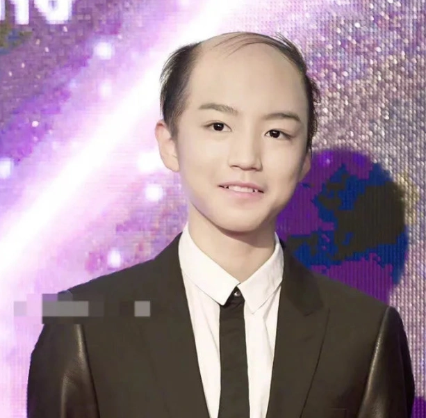 当红男星秃头对比照,胡歌最丑王俊凯沧桑,第4个位列金鹰榜首