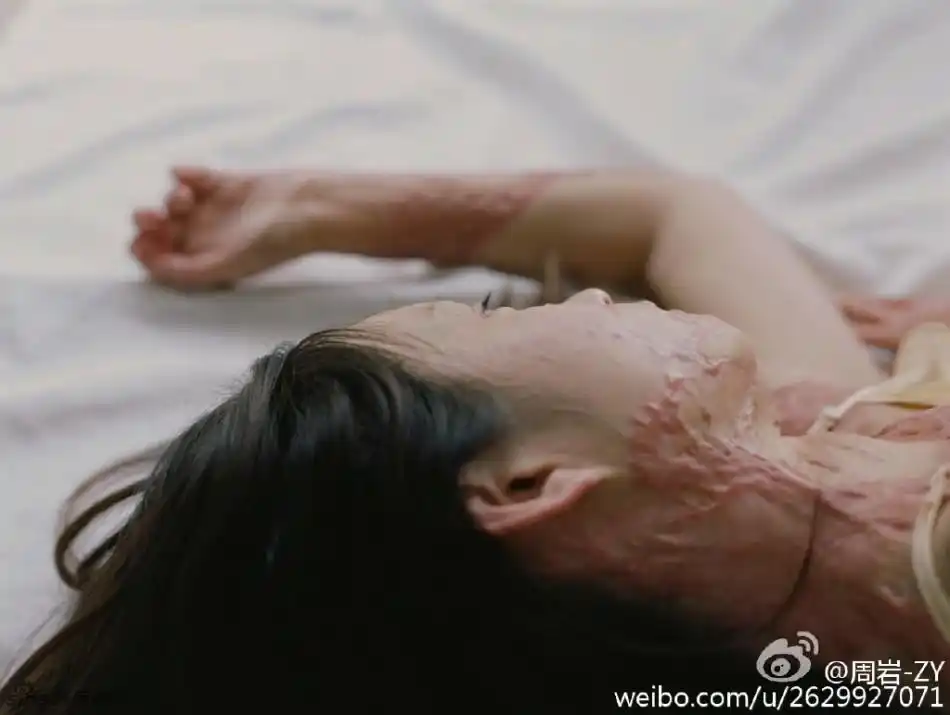 组图:烧伤女孩周岩旧照甜美清纯 性格坚强阳光_高清图集_新浪网