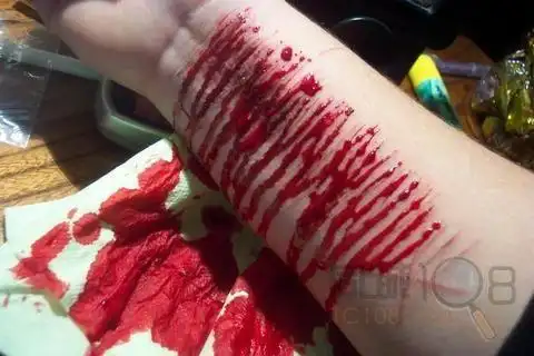 疯狂粉丝疑割腕十数刀求偶像戒毒(慎入)