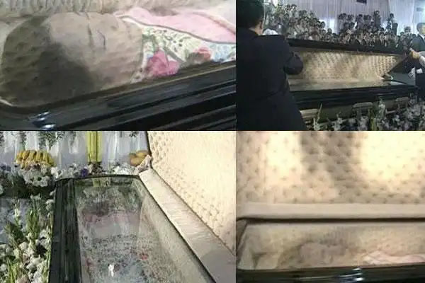 邓丽君绝密尸检照首度曝光 疑生前曾遭人掌掴(组图)