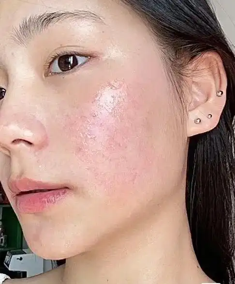 为啥用很贵的护肤品,皮肤还是不好不得不说敏感肌真的好难每 - 抖音