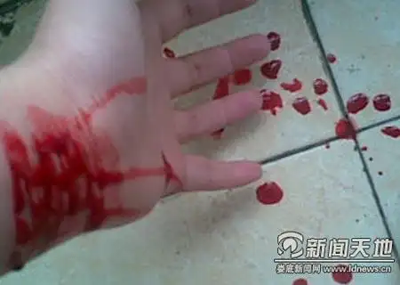 湖南大三女孩恋上割腕 自拍发给网友"欣赏"