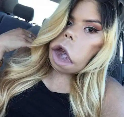 女子脸生肿瘤破相 奇怪面容吓坏路人(图)