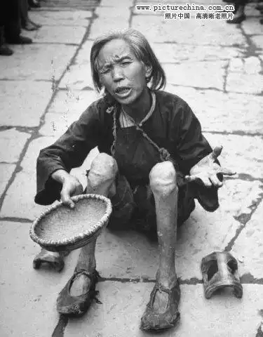 古代乞丐最歹毒骗人术采生折割制怪物组图