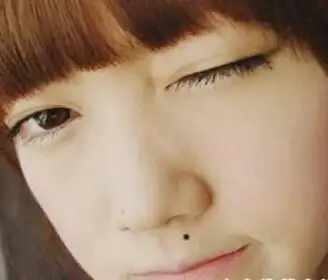 解析人中有痣的面相 人中有痣是好是坏?