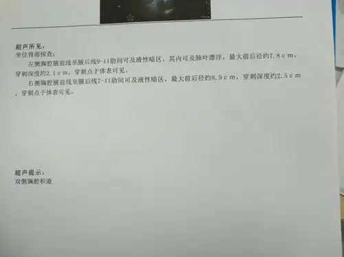 胸部彩超双侧中到大量胸腔积液.