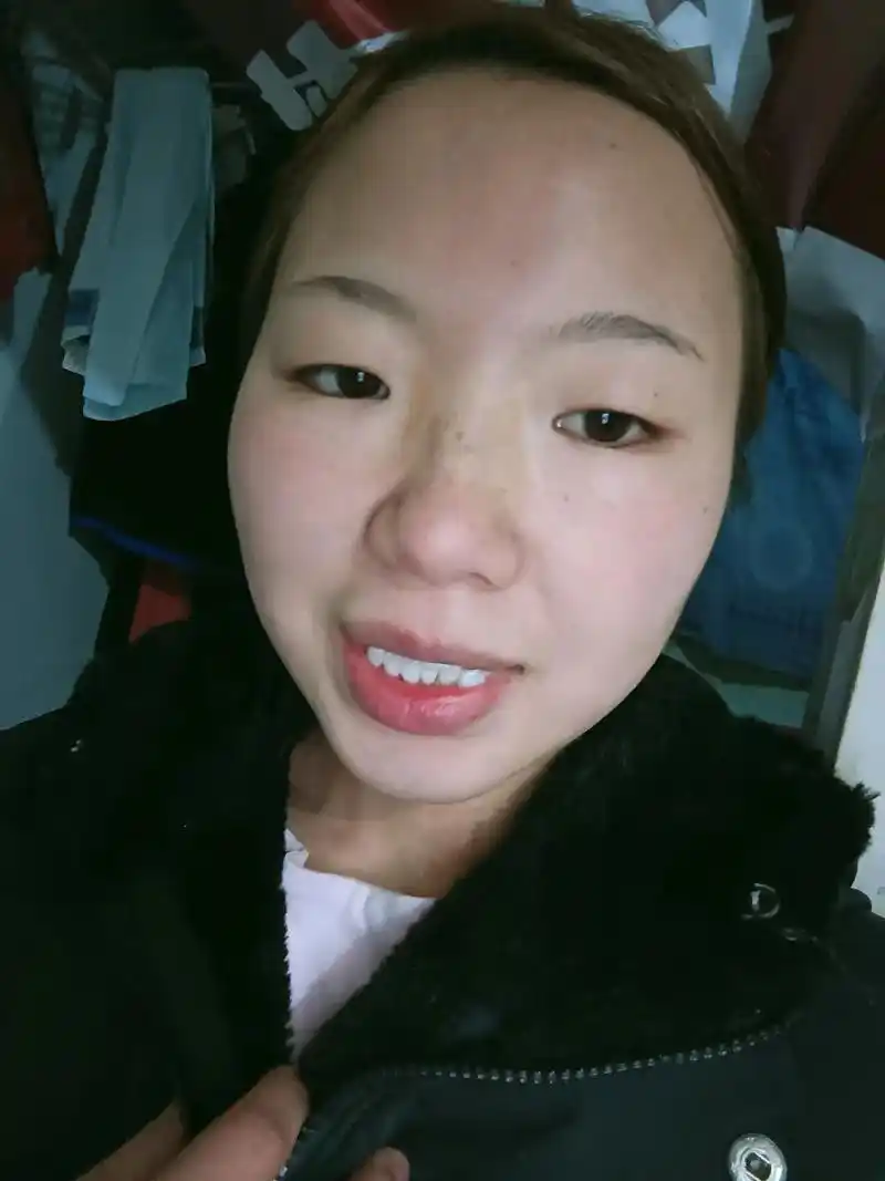 虽然素颜照片很丑看 是真的会更自信 但牙齿白是真的好看 来跟 - 抖音