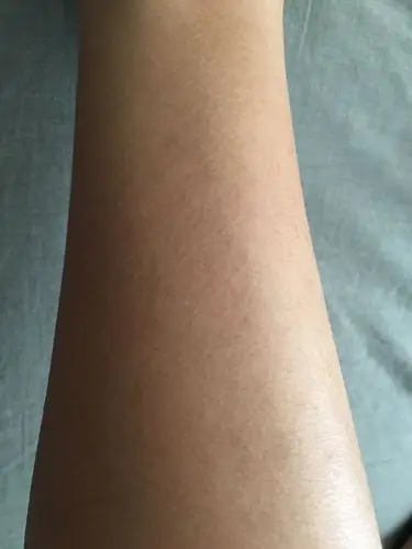 怎么可以把这个干裂纹给搞掉? 小腿的