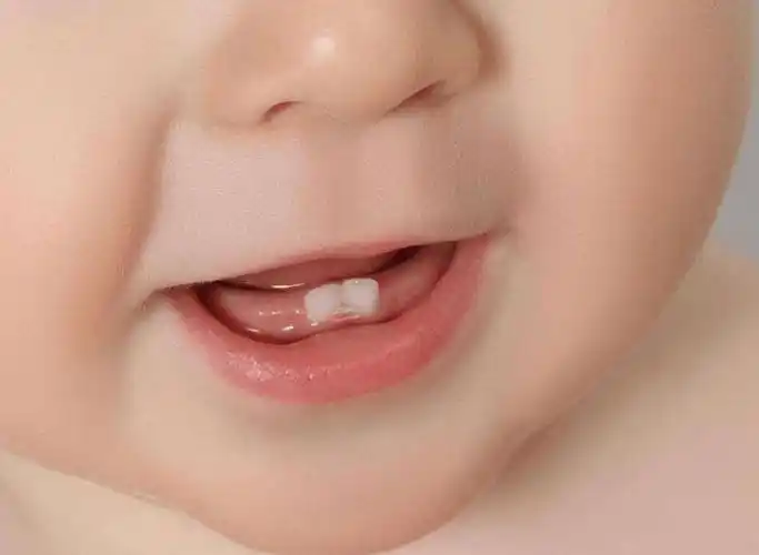 育儿小诀窍乳牙萌出后需细心照料