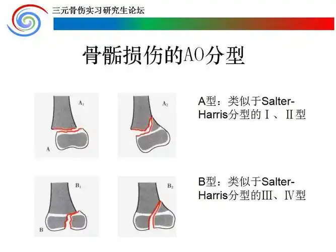 儿童肘关节骨骺损伤诊疗概要-健康小贴士-三元岐黄医康