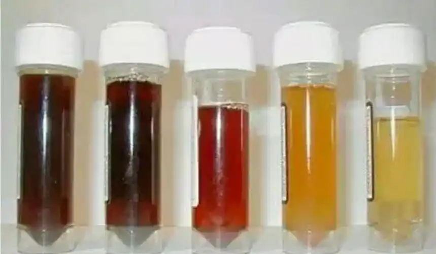 尿液颜色偏红是什么原因,尿液偏红色是什么情况