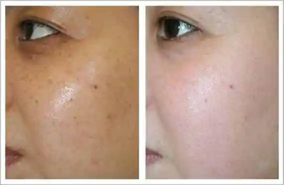 【脸色发黄怎么改善】脸色暗沉发黄什么原因?这6种常见原因要警惕!