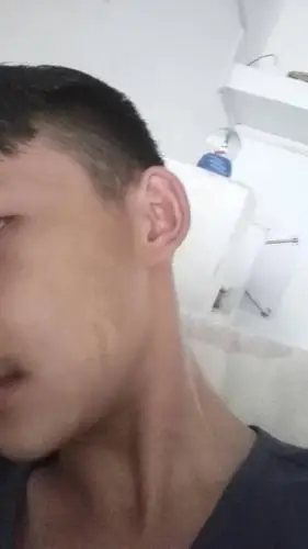 脸上涂了汗斑露之后,脸上很痛,然后就这样,现在该怎么办