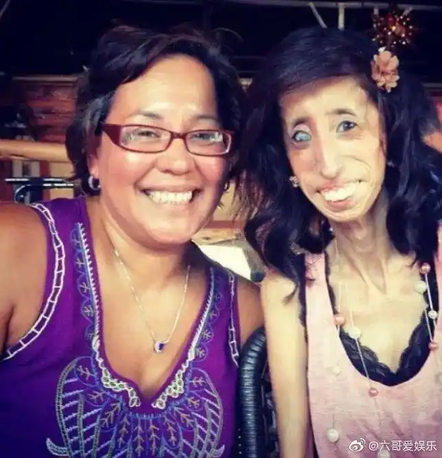 世界上最丑的女人