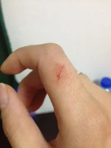 为什么有时候手破了却不疼,发现伤口的时候就疼了?