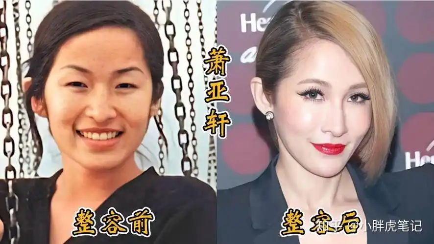 18位女明星整容前后对比,邵音音面目全非,杨颖堪称整容模板!