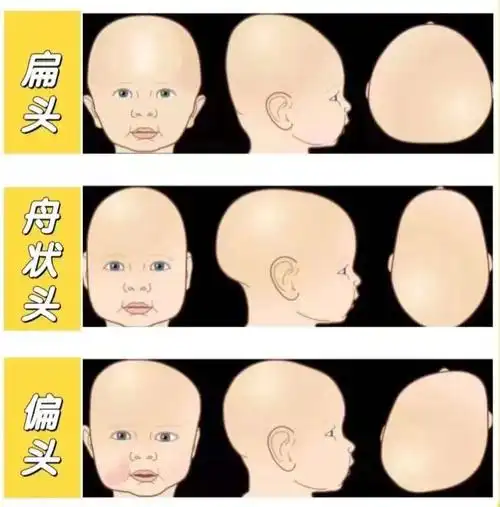 如何让宝宝养成圆润头型聪明爸妈这样做