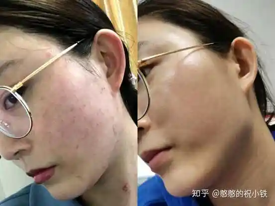 修复敏感肌时,你踩过哪些雷?有哪些值得分享的宝藏干货?