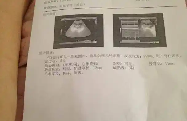 首先是胎囊,这个是在怀孕早期可以看到的,它的大小在怀孕一个半月的