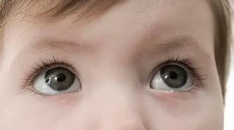 宝宝眼睛斜视不好看, 那么父母该如何帮助宝宝预防呢?