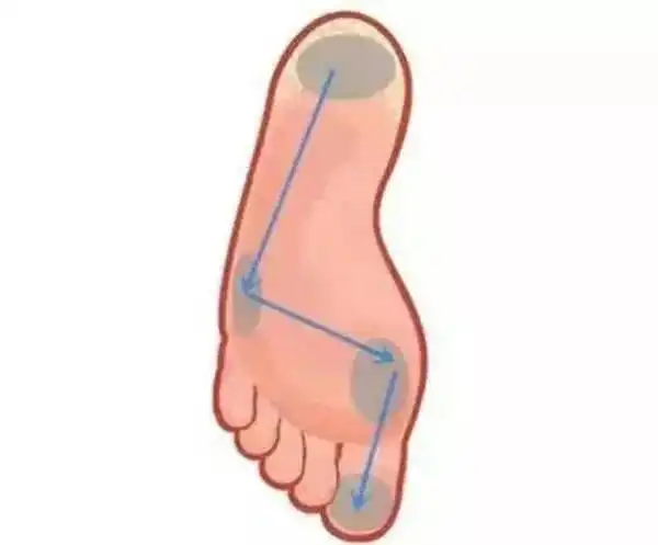 人走路的方式与足弓的特点息息相关,从脚跟落地到脚掌离开地面,足底