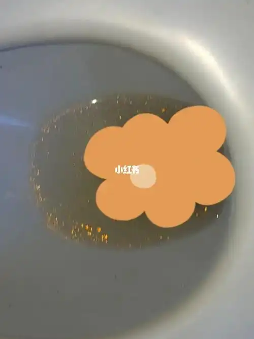 9872157215慎入慎入 奥利司他排油_排油_炸鸡_烤肉_月经