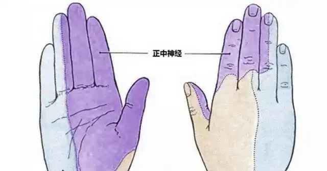 结果发现:大鱼际肌明显萎缩,拇指外展受限,对掌功能变差,患者拇指