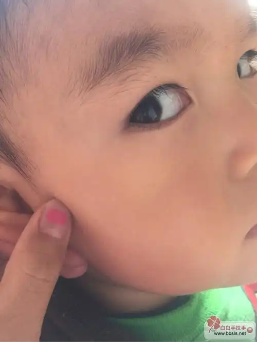 看看宝宝脸颊一个小点是什么?
