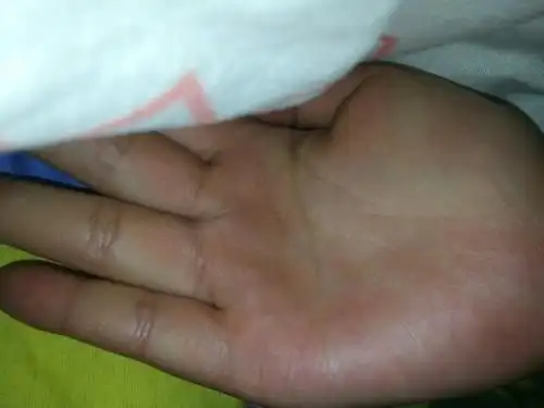 我是断掌,女右手生命线中间断开而且第二段位置跟第一段错开了,第一段