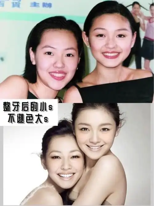 别人已经箍好成女神啦我们认识的许多明星其实也是有_圈子-新氧美容