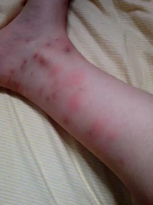 谁知道这是什么 在床上发现的