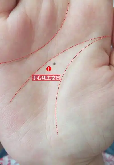 手心有痣是主大吉,我记得以前写文章写到过,不管是先天的手心痣,还是