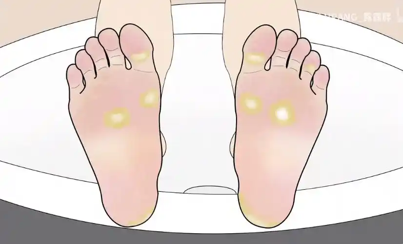 从糙脚丫到纤纤玉足你只差这一步