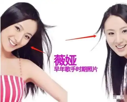 薇娅"早期照"被疯传,看清那时候的颜值,怪不得能出道当歌手