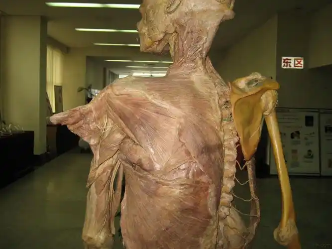 发几张真人解剖的标本照片 - 中医针推外治版 - 爱爱医医学论坛