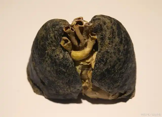 长年累月吸烟,肺是如何变黑的?