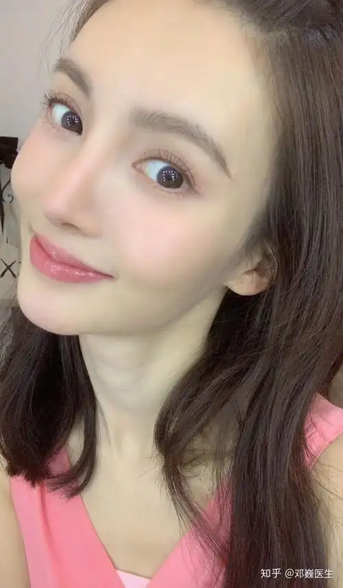 脸型不算大,苹果肌饱满,肤色白皙,但主要有问题的是鼻子 ,金晨的鼻子