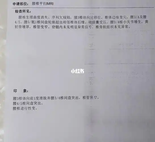 腰间盘突出  在老家拍的片子,给我妈挂了北京301和积水潭的号,下秩ゥ